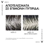 VICHY Dercos Anti Dandruff-Σαμπουάν Για Ξηρά Μαλλιά Refill 390ML - Image 2